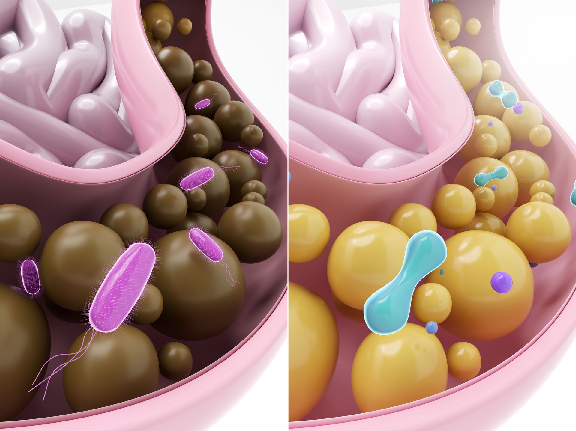 Gut health comparison of unhealthy vs healthy intestine, probiotics and prebiotics for microbiome balance 3D render